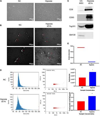 Hypoxic culture of umbilical cord mesenchymal stem cell-derived sEVs prompts peripheral nerve injury repair